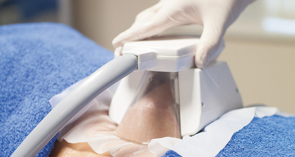 How Fat Freezing and HIFU Work Together? 2 Multiple Areas in One Session HIFU and Fat Freezing Warminster